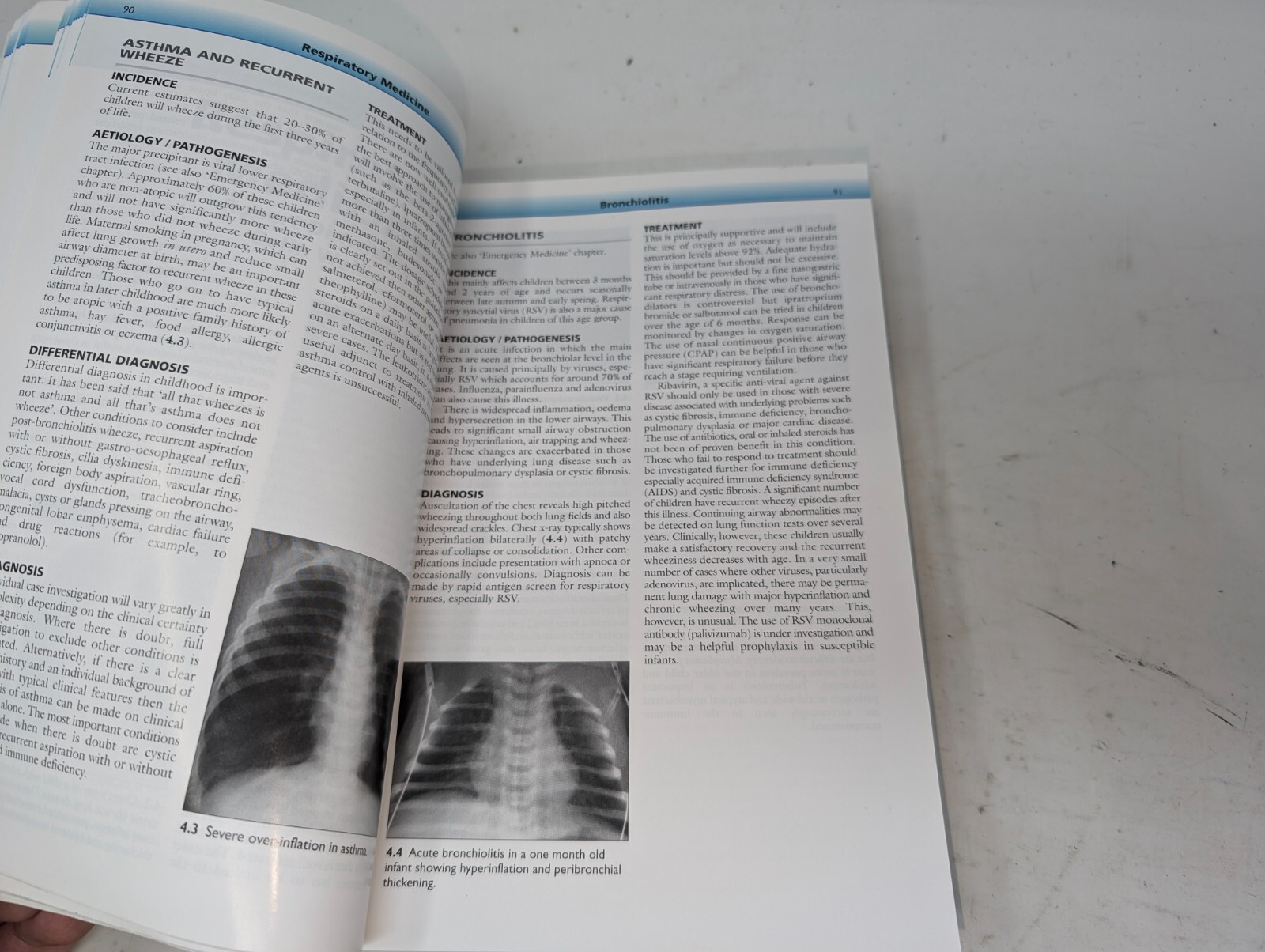 The Great Ormond Street Color Handbook of Paediatrics and Child Health (204)