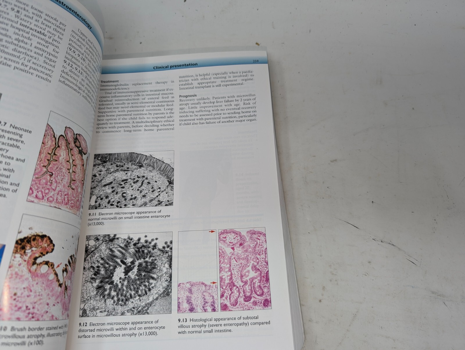 The Great Ormond Street Color Handbook of Paediatrics and Child Health (204)