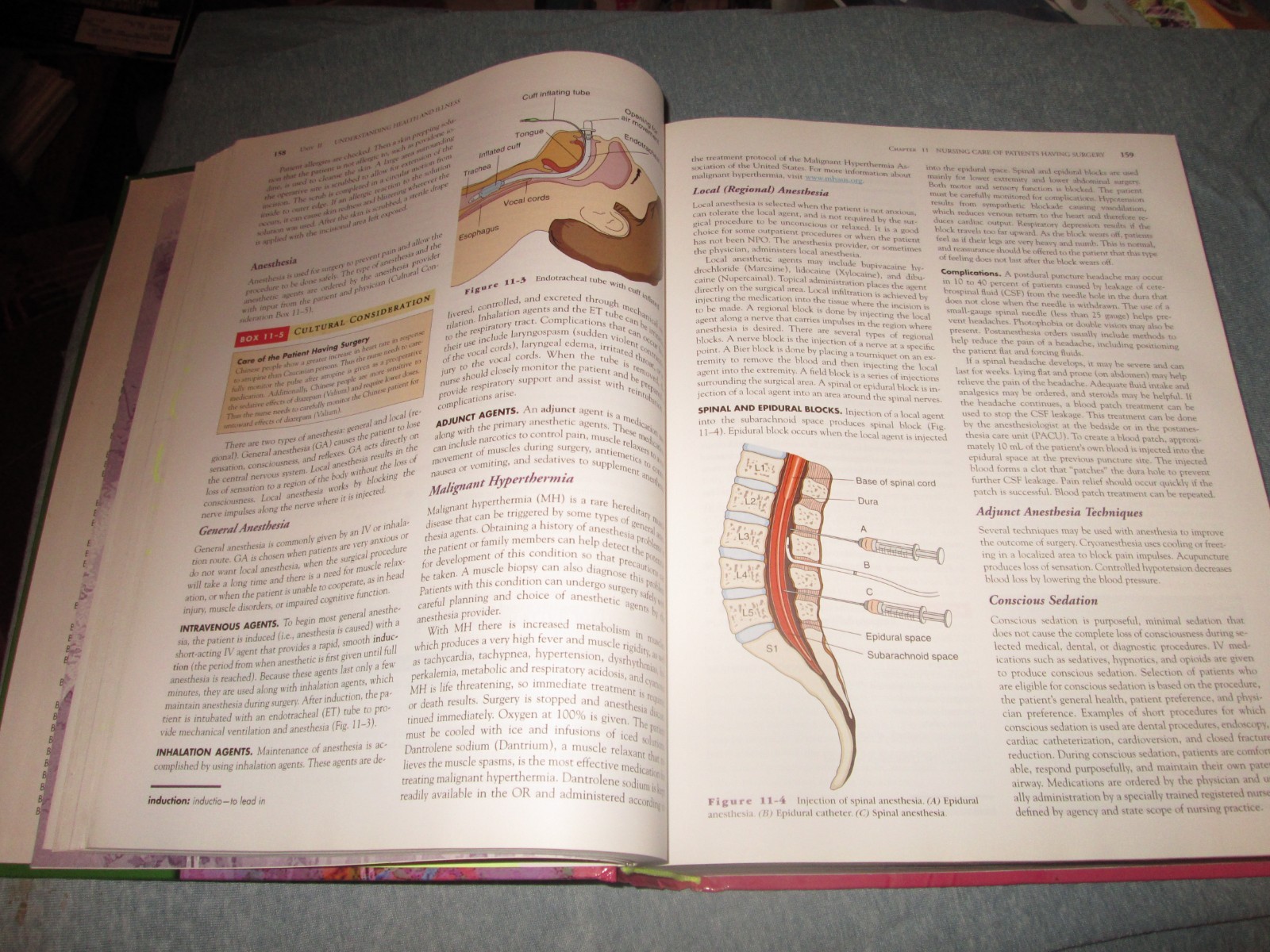 Understanding Medical-Surgical Nursing – Linda S Williams, F.A. Davis Company