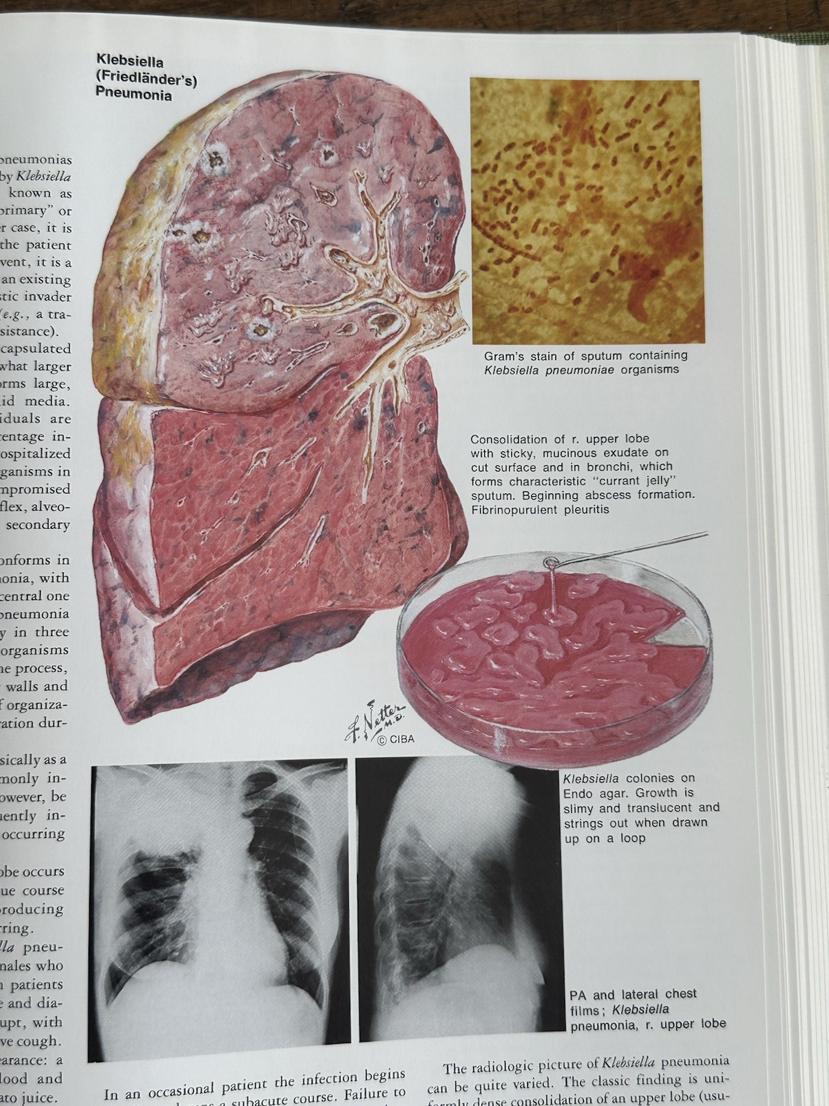 Frank H Netter CIBA Medical Illustrations Heart Kidneys Respiratory 3 Book Set