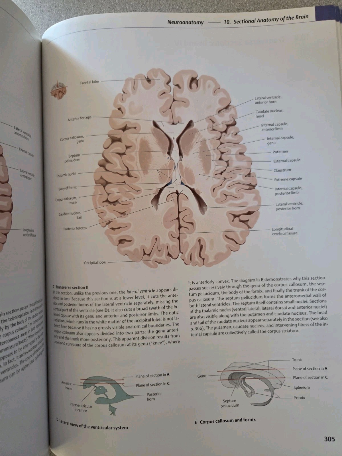 Thieme Atlas of Anatomy Ser.: Head and Neuroanatomy by Erik Schulte, Lawrence…