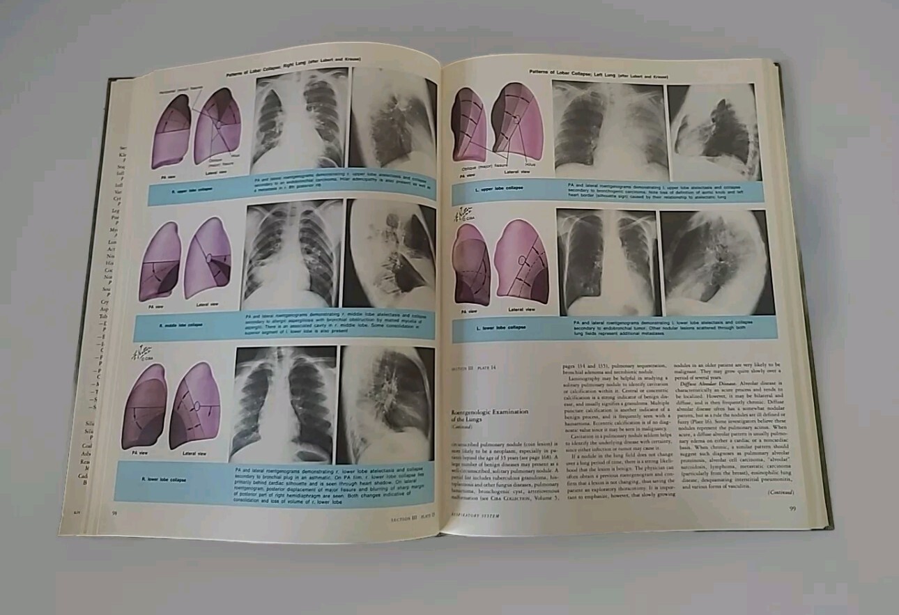 1979 Netter Green Book Collection: Respiratory System by Frank H. Netter