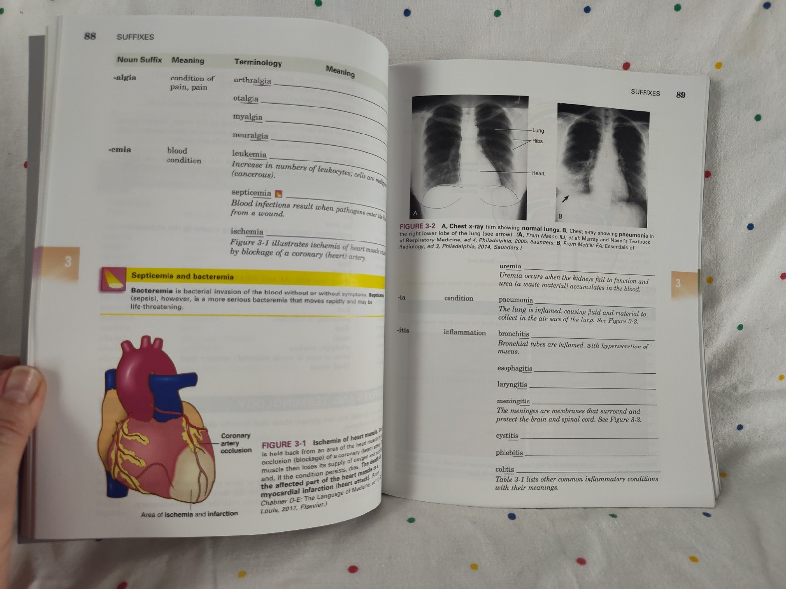 Medical Terminology A Short Course By Davi-Ellen Chabner 8th Edition ST46