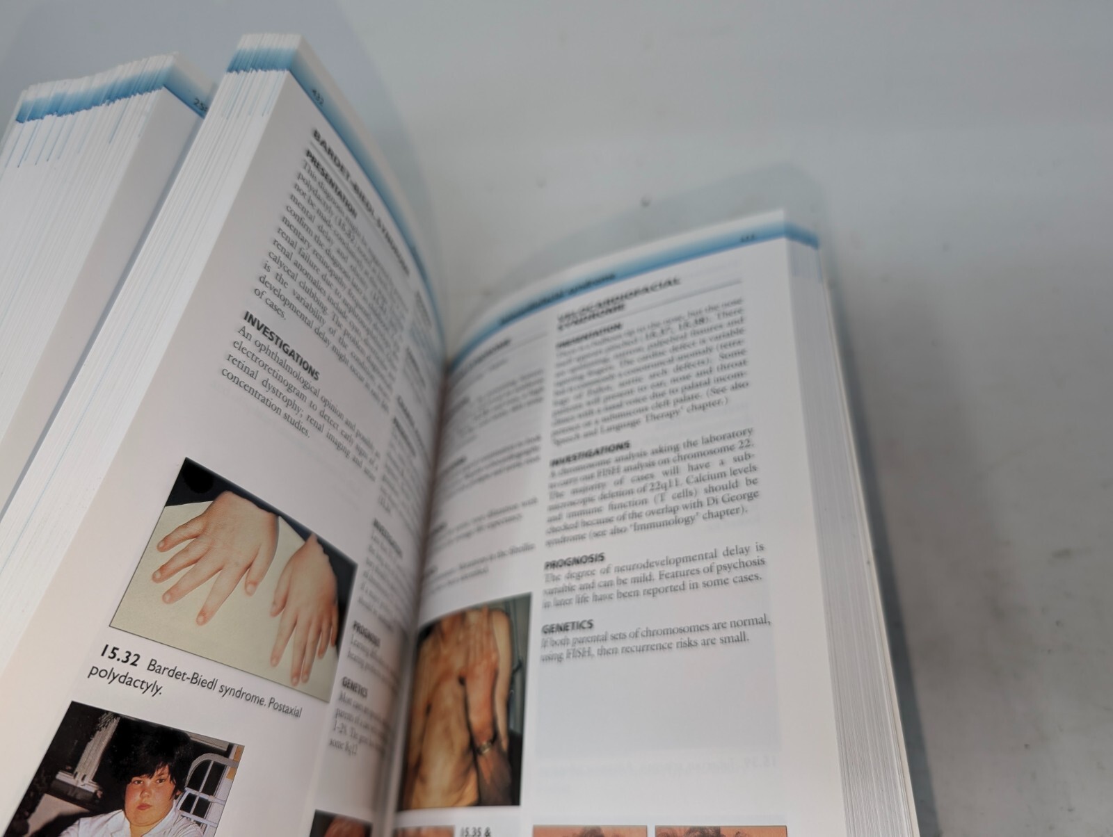 The Great Ormond Street Color Handbook of Paediatrics and Child Health (204)