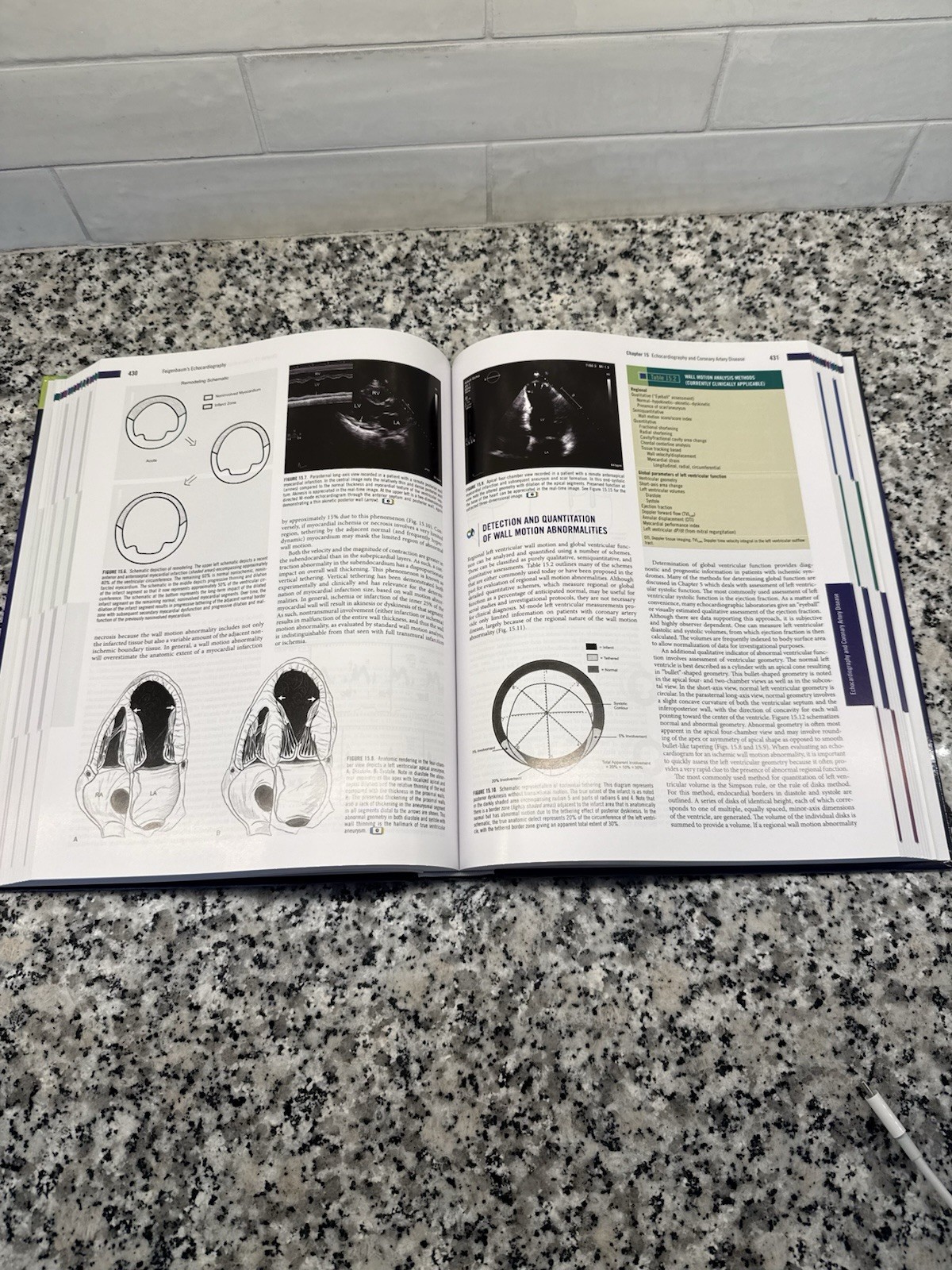 Wolters Kluwer Feigenbaum’s Echocardiography 8th Ed Cardiology Armstrong Ryan