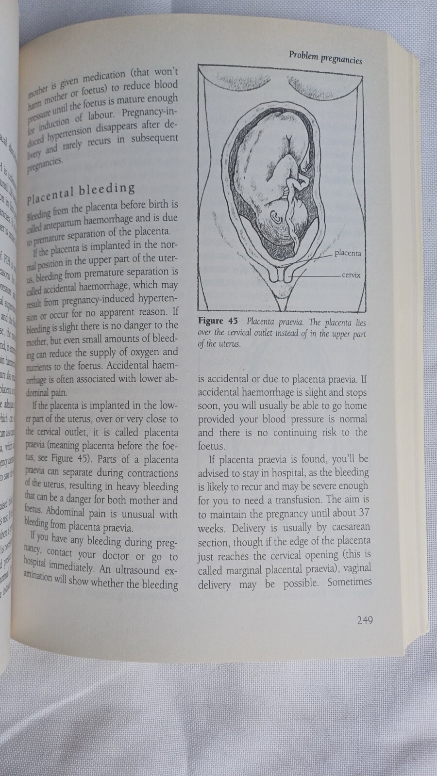 Used Book Penguin Guide to Women’s Health Australian 440 pages Very Good