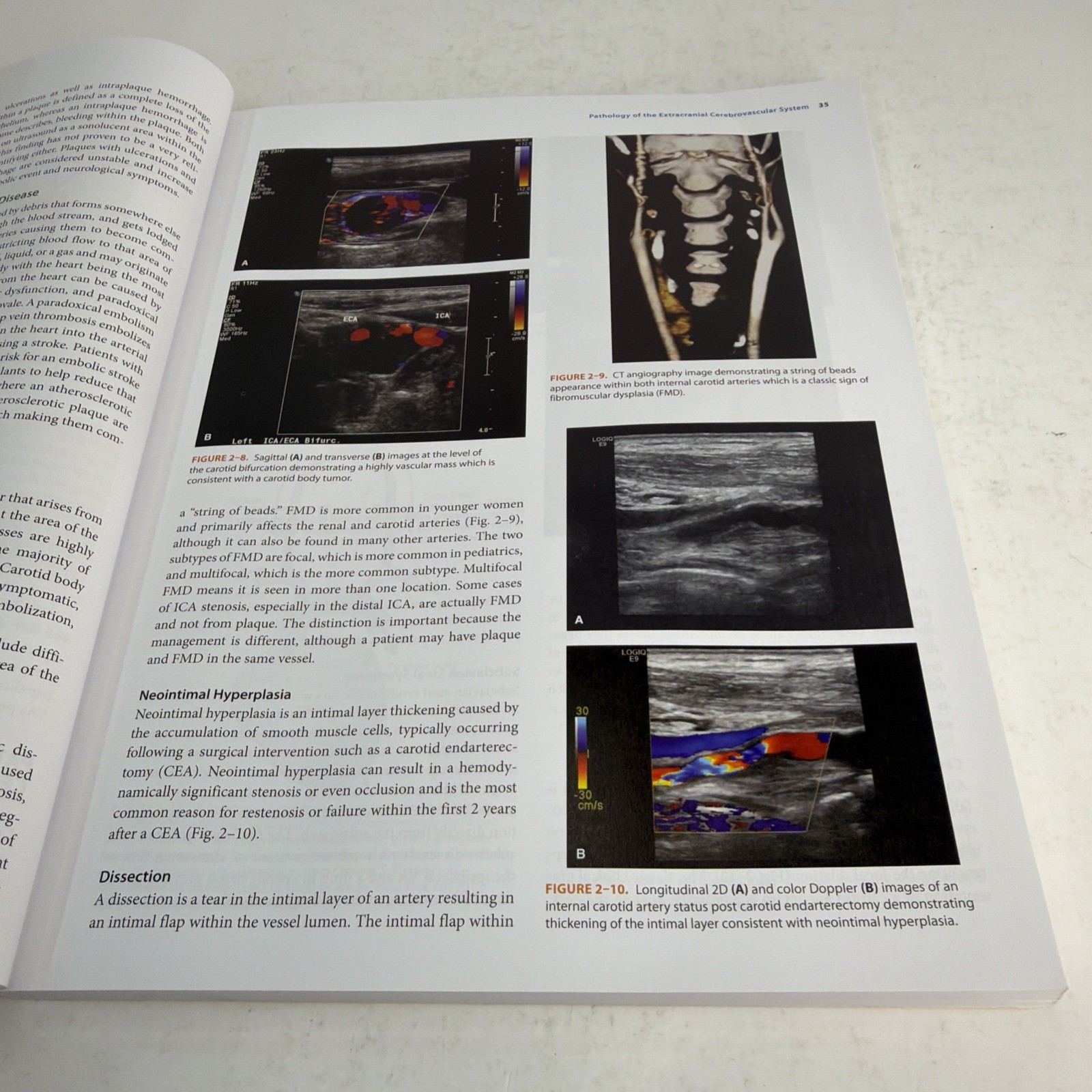 Vascular Technology Examination PREP 2nd Edition 2021 Paperback