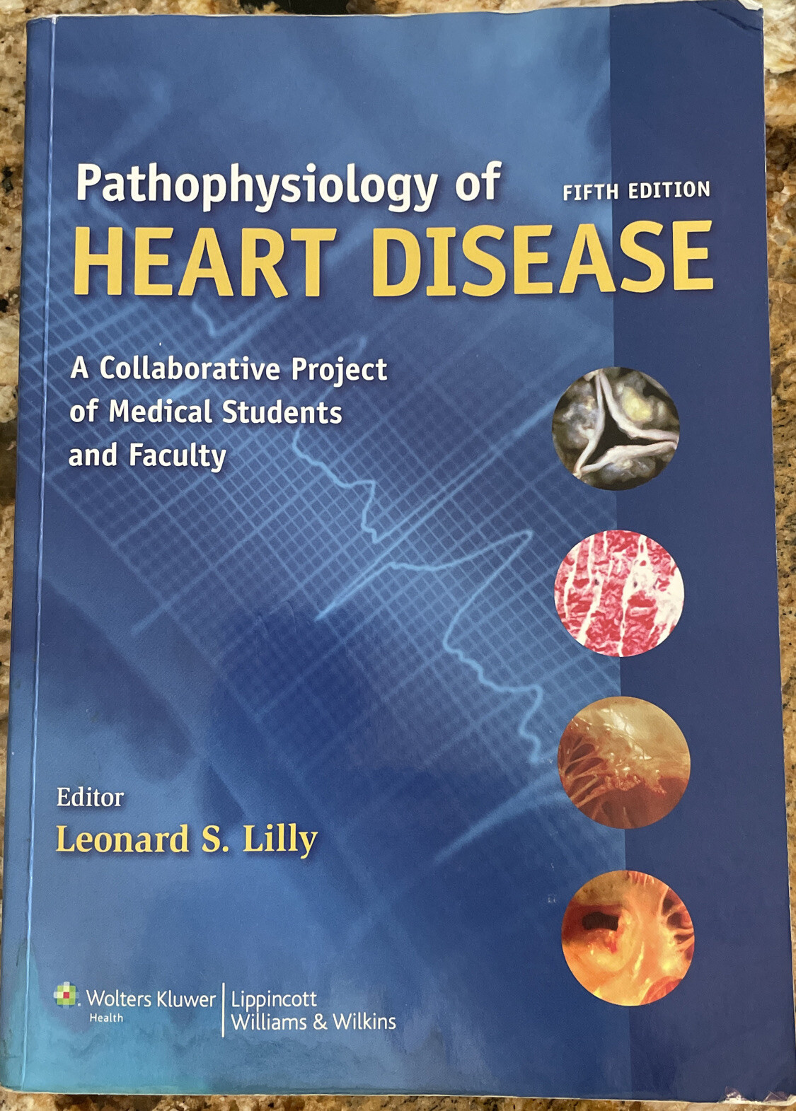 Pathophysiology of Heart Disease 5th Edition Leonard S. Lilly