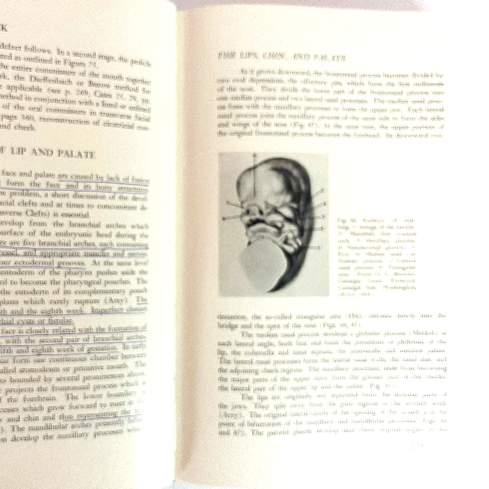 Vintage Plastic and Reconstructive Surgery 3rd Edition Book Hardcover 1971 Hans