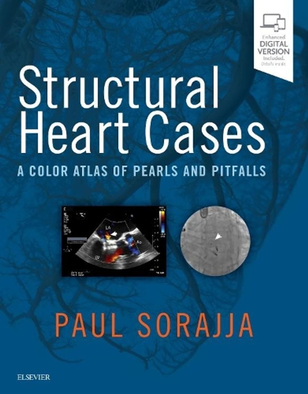 Structural Heart Cases: A Color Atlas of Pearls and Pitfalls by Paul Sorajja (En