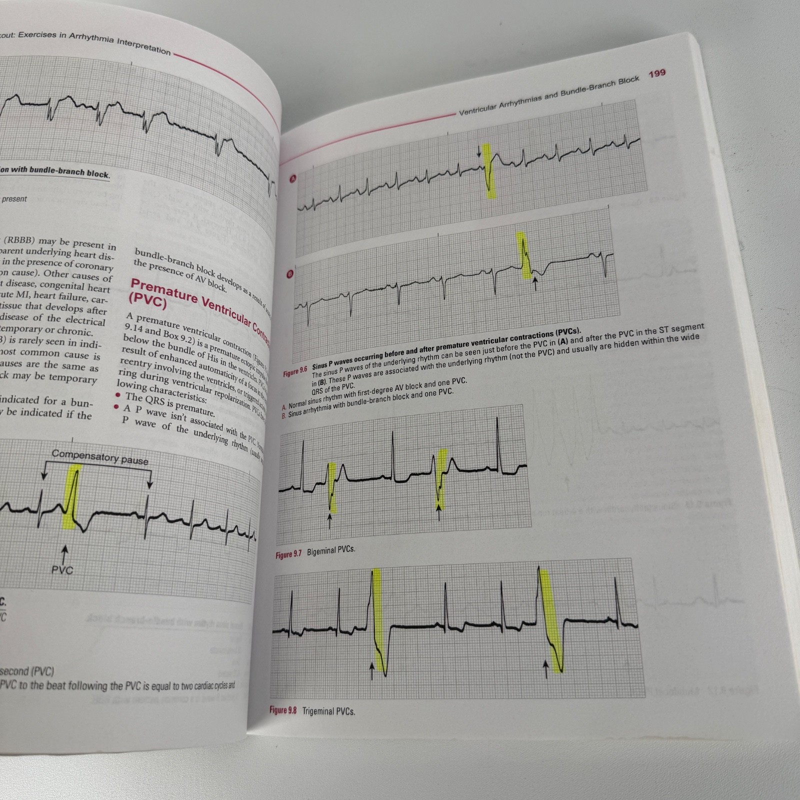 ECG Workout, Seventh Edition / 7th Ed. Jane Huff, Exercises in Arrhythmia Interp