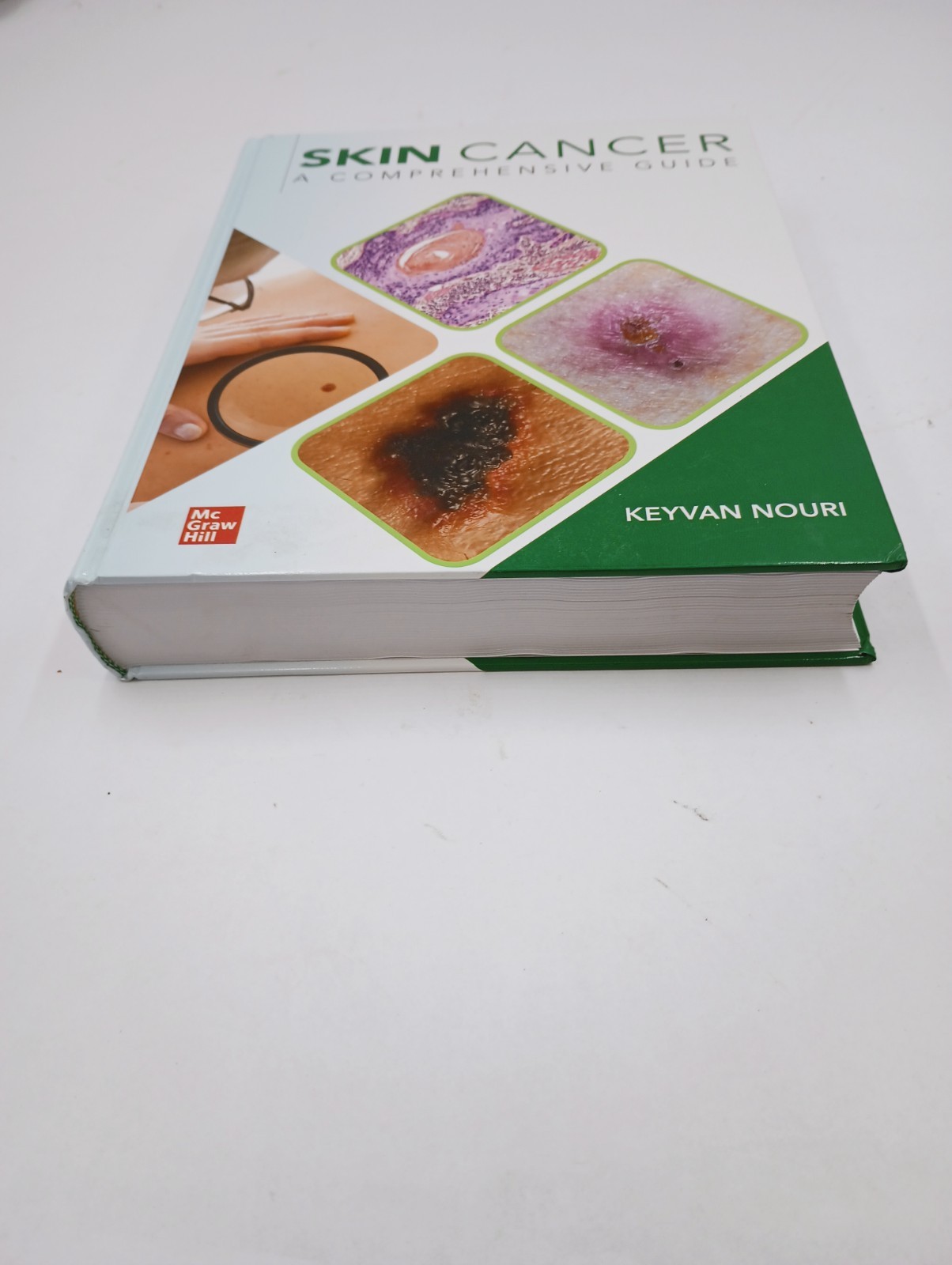 SKIN CANCER A COMPREHENSIVE GUIDE KEYVAN NOURI MCGRAW HILL TEXTBOOK HARDCOVER