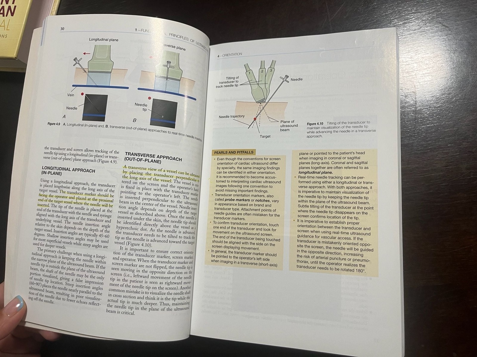 Point-of-Care Ultrasound by Soni, Arntfield, and Kory (Elsevier Saunders)