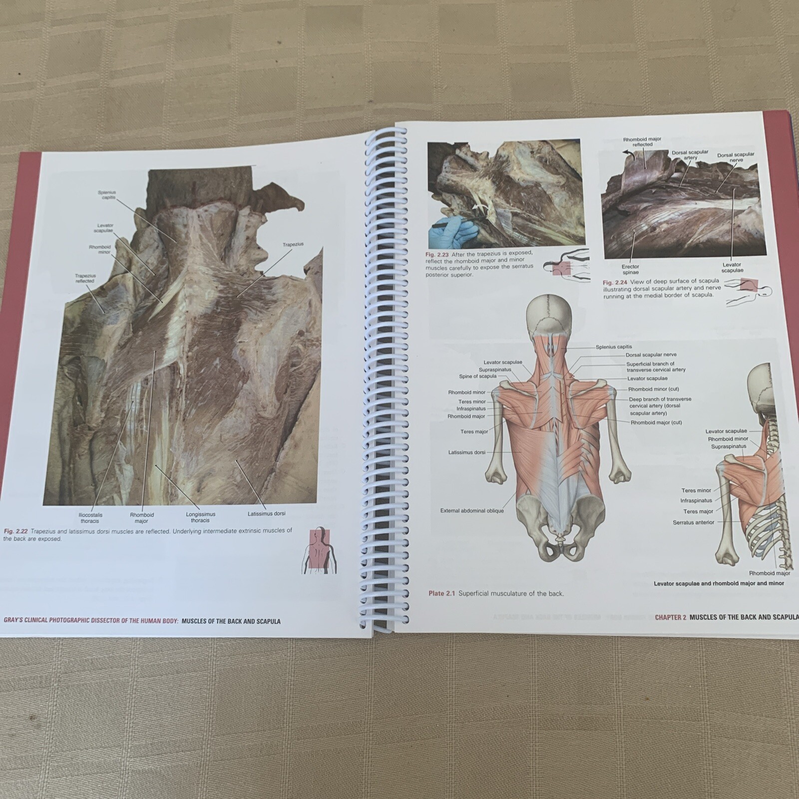 Gray’s Anatomy Ser.: Gray’s Clinical Photographic Dissector of the Human Body by