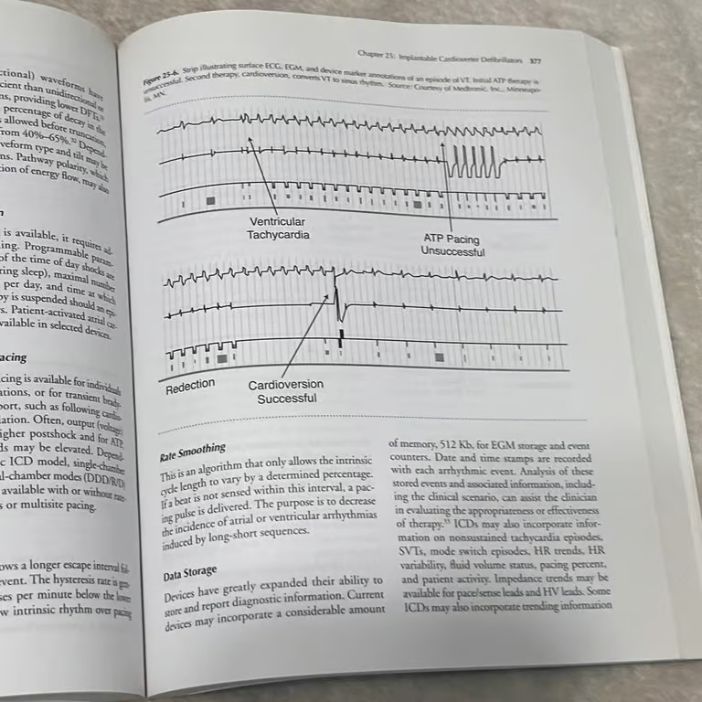 Invasive Cardiology A Manual For Cath Lab Personnel Textbook 3rd Ed 2011