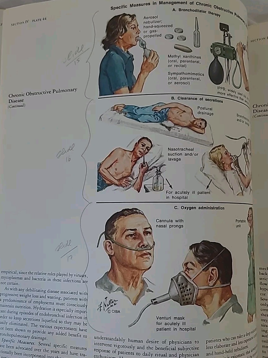 1979 Netter Green Book Collection: Respiratory System by Frank H. Netter