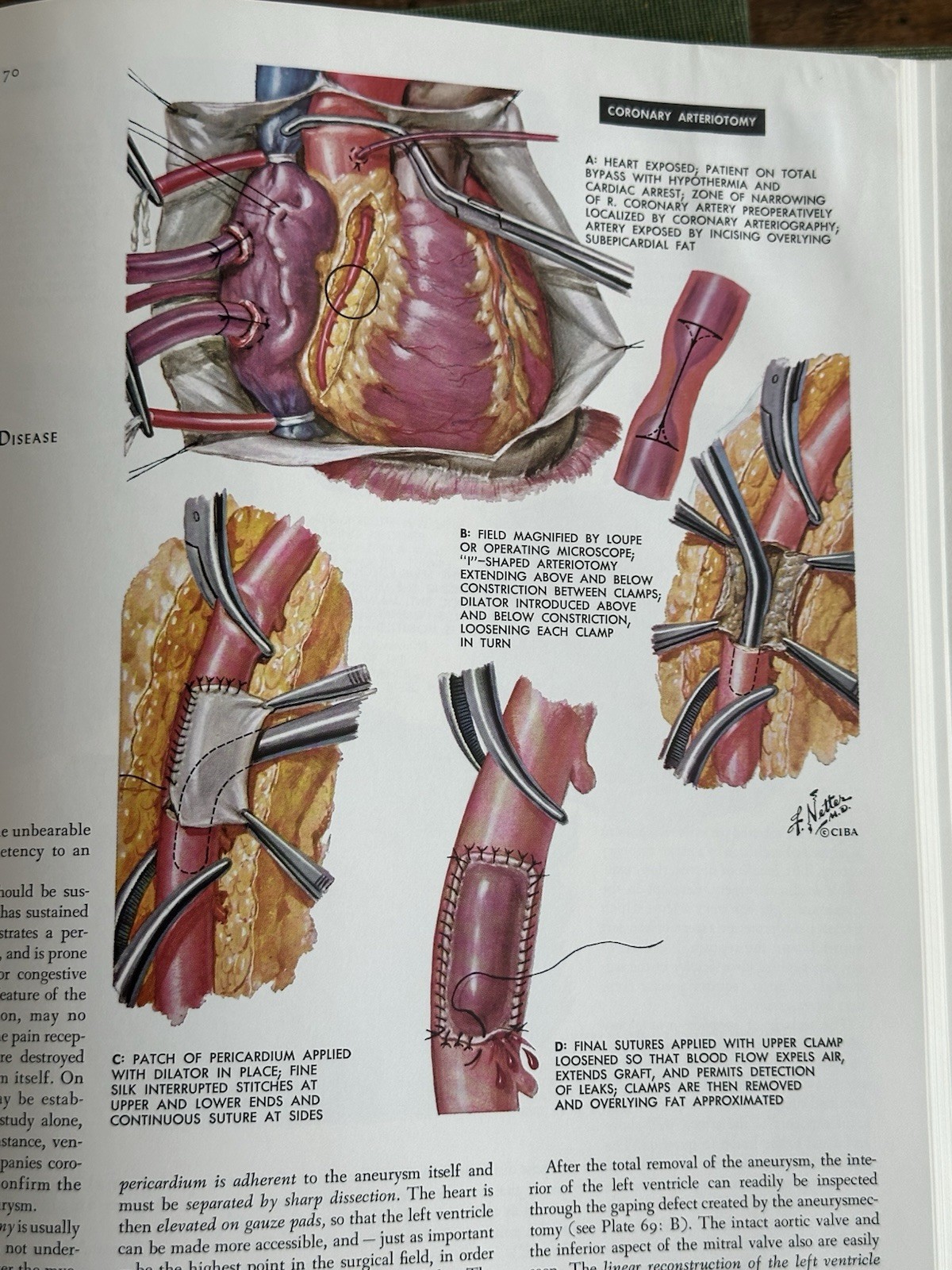 Frank H Netter CIBA Medical Illustrations Heart Kidneys Respiratory 3 Book Set
